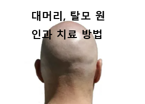 대머리.png